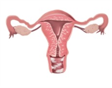 thrush yeast infection on vaginal walls